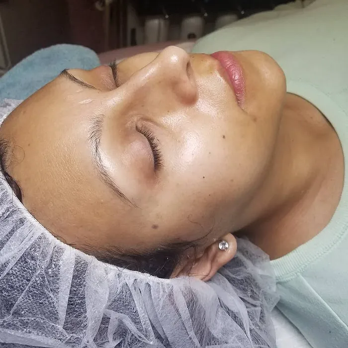 Skin Karma Picture 5