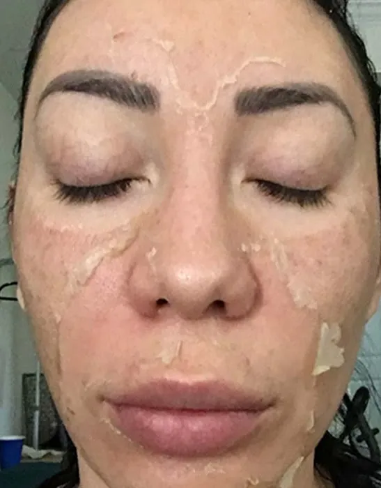 Skin Karma Picture 2