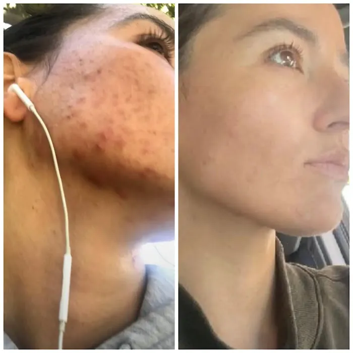 Skin Karma Picture 8