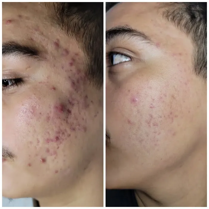 Skin Karma Picture 6