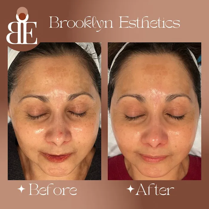 Brooklyn Esthetics Picture 6