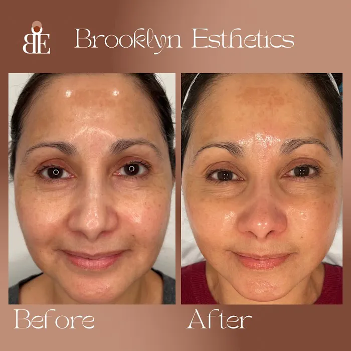 Brooklyn Esthetics Picture 10