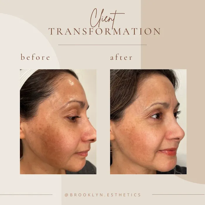 Brooklyn Esthetics Picture 8