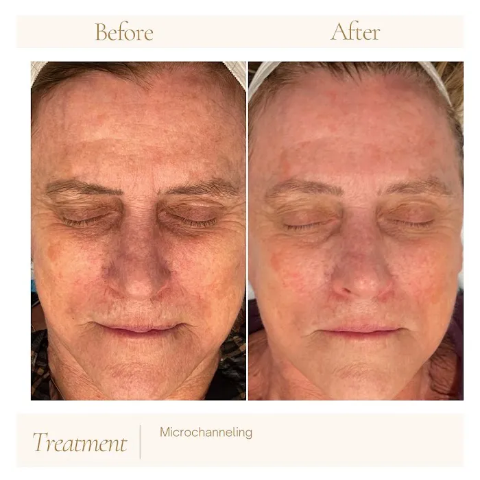 Brooklyn Esthetics Picture 7