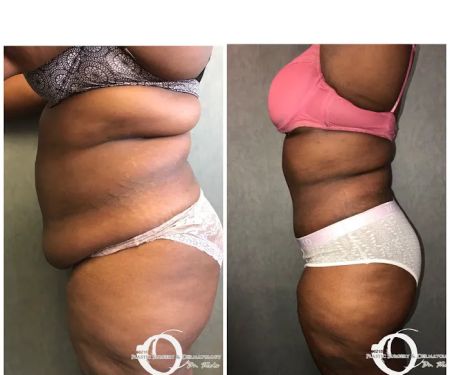 90210 Cosmetic Surgery and Dermatology