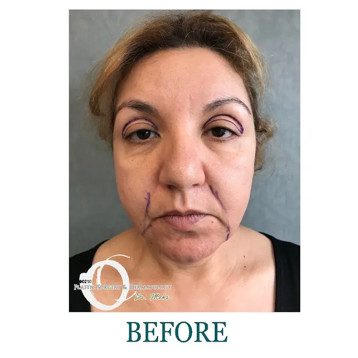 90210 Cosmetic Surgery and Dermatology Picture 4