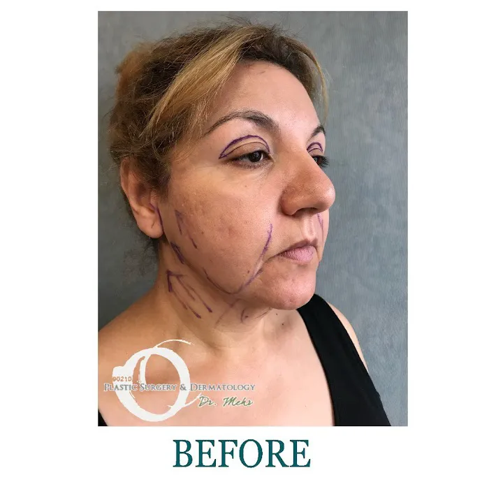 90210 Cosmetic Surgery and Dermatology Picture 7