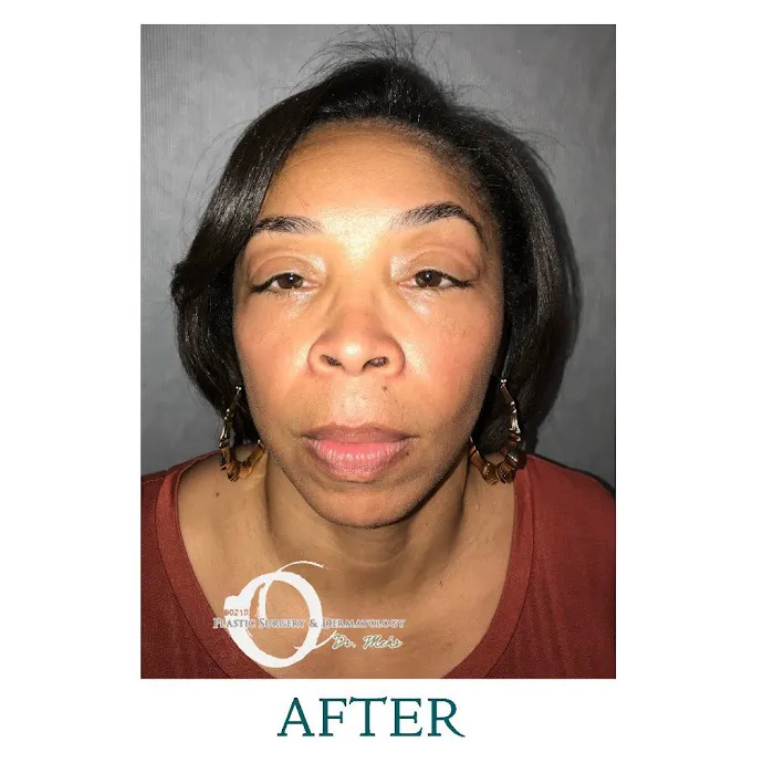 90210 Cosmetic Surgery and Dermatology Picture 6