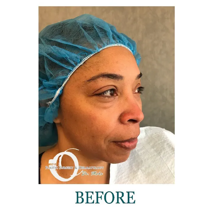 90210 Cosmetic Surgery and Dermatology Picture 5