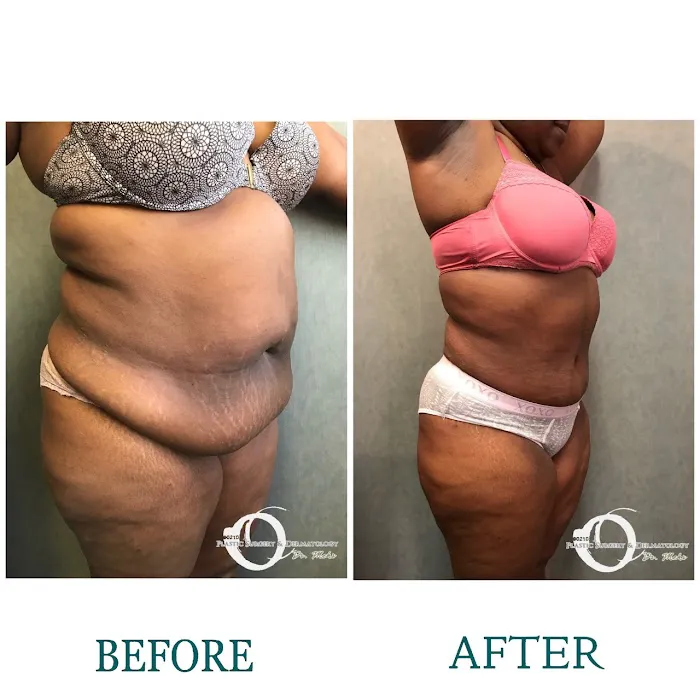 90210 Cosmetic Surgery and Dermatology Picture 8