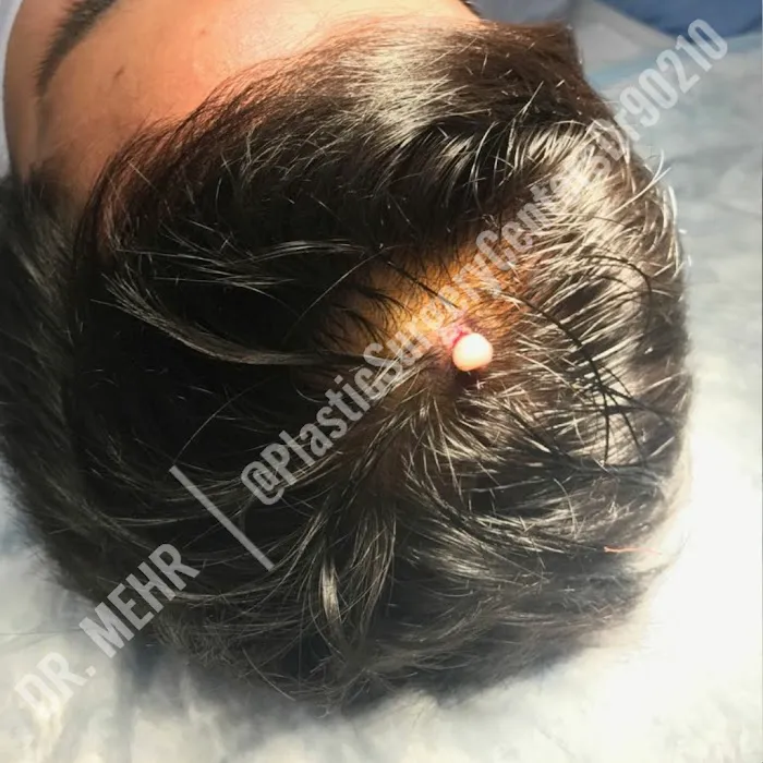 90210 Cosmetic Surgery and Dermatology Picture 9