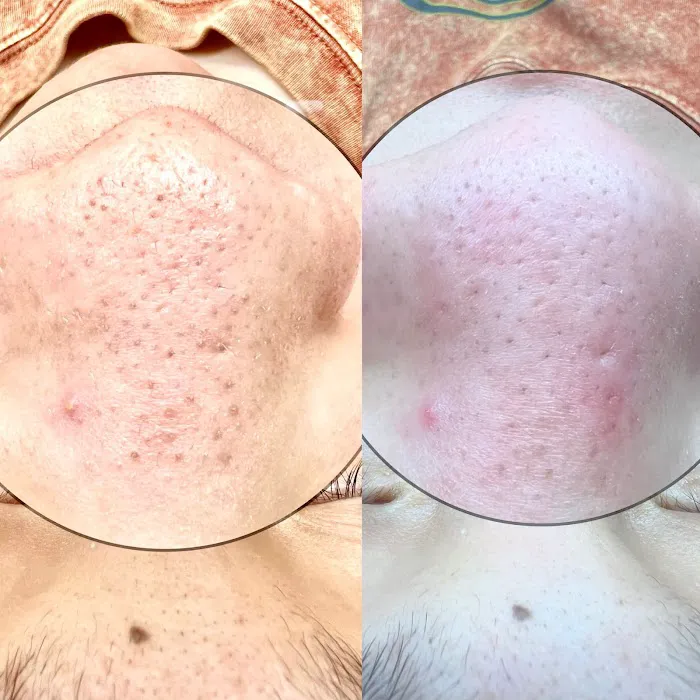 Glowy Ambitions Picture 4