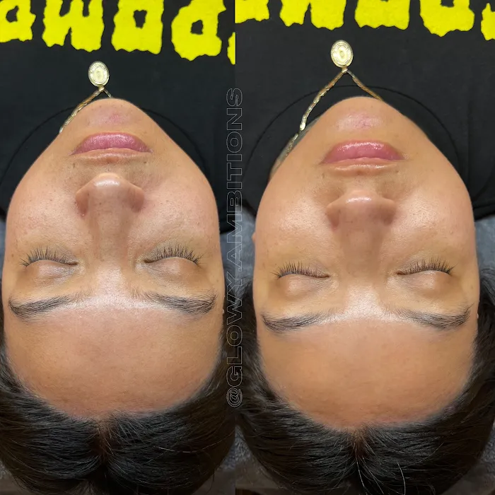 Glowy Ambitions Picture 6