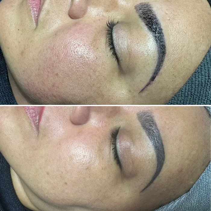 Soft Esthetics Picture 2