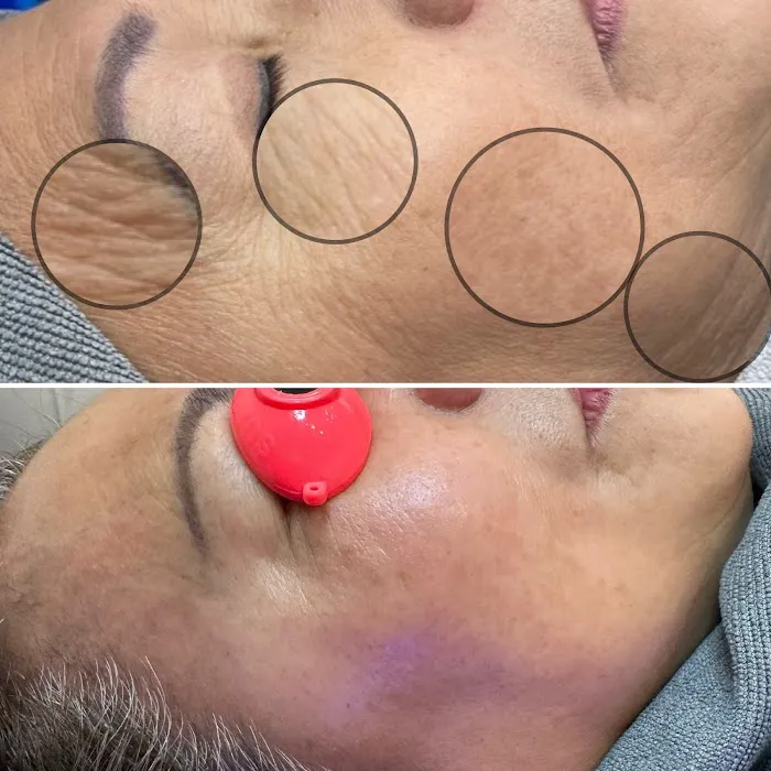 Soft Esthetics Picture 5