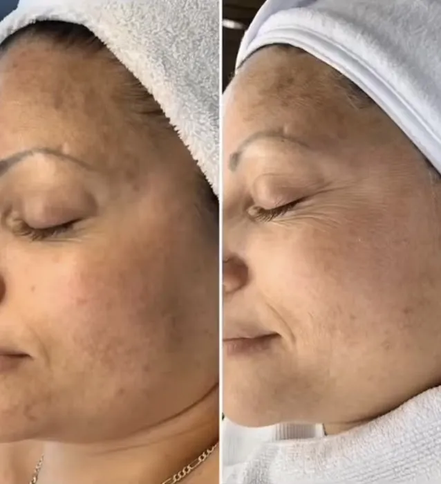 Soft Esthetics Picture 4