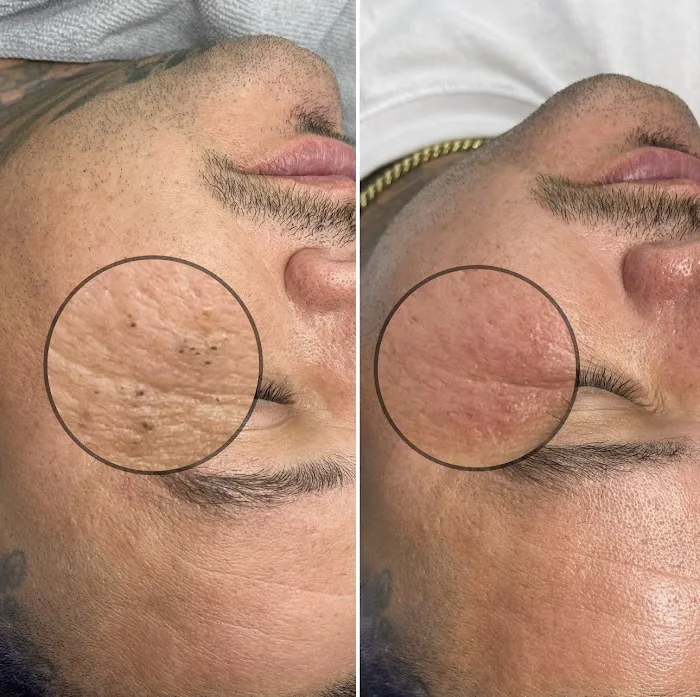 Soft Esthetics Picture 3