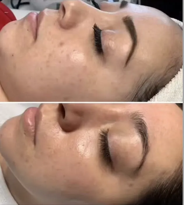 Soft Esthetics Picture 6