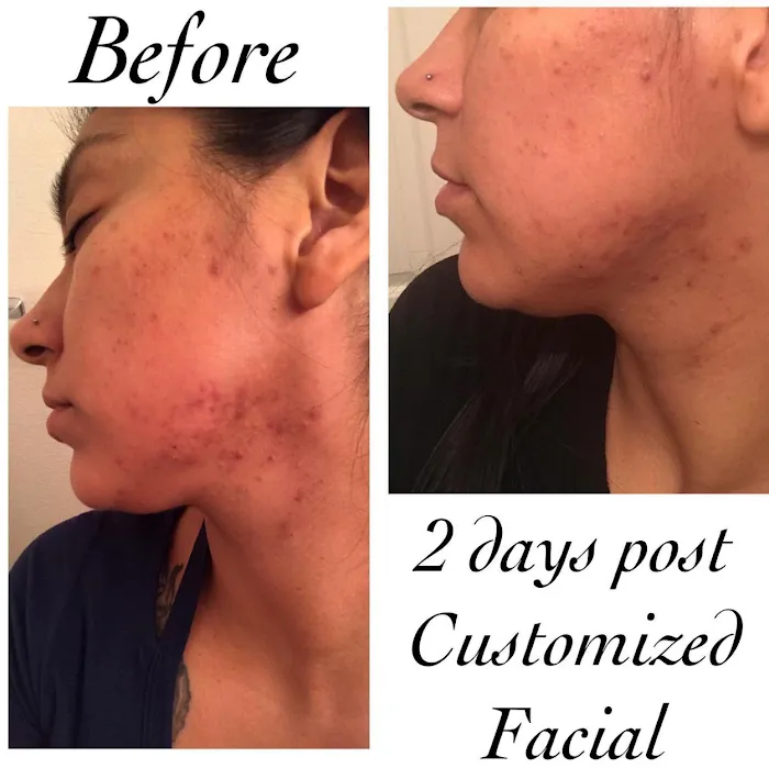 Soft Esthetics Picture 8