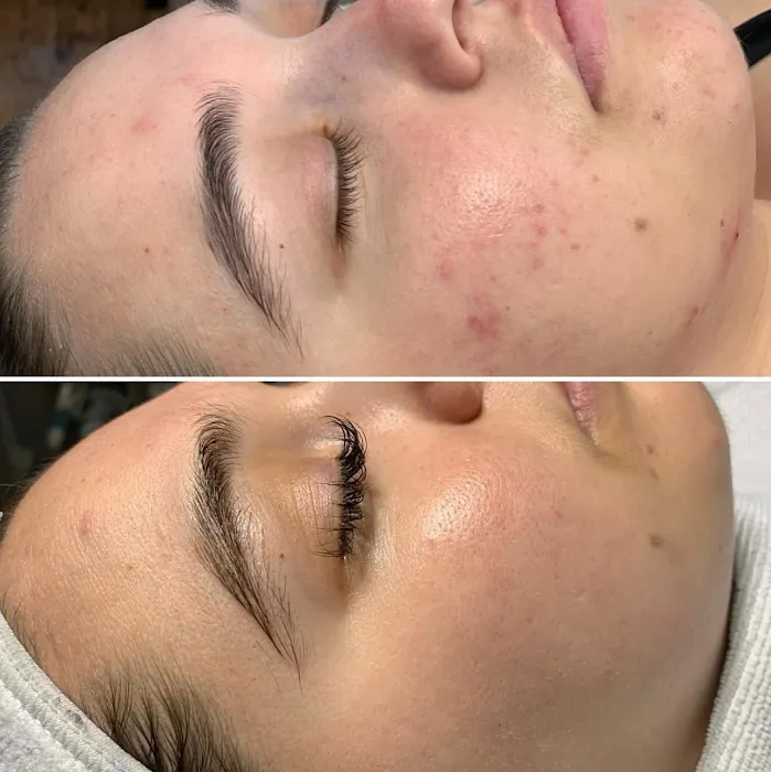 Soft Esthetics Picture 9