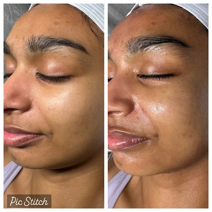 Fadia Beauty | Facial Salon near Van Nuys | Anti Aging Facial Picture 3