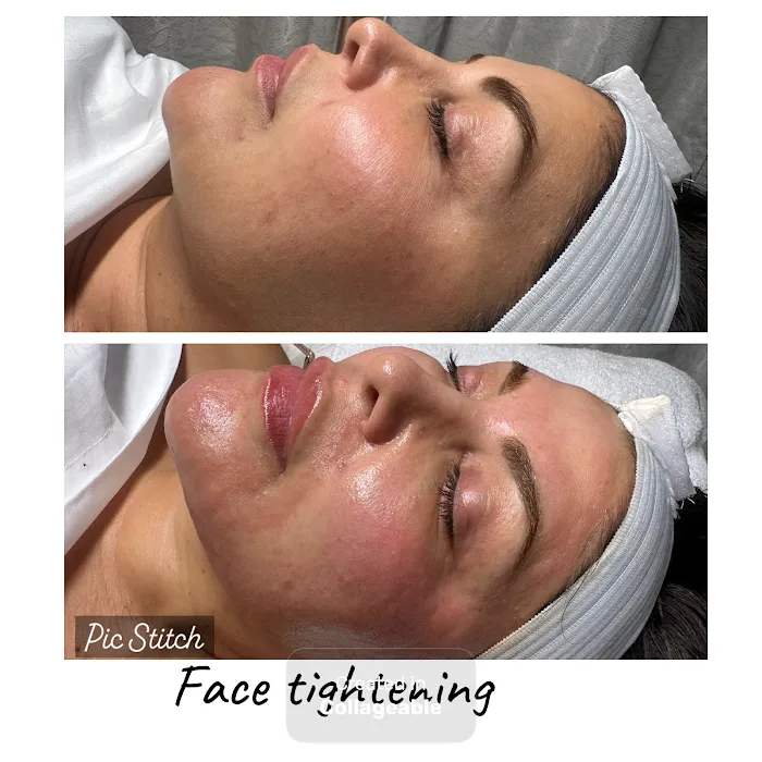 Fadia Beauty | Facial Salon near Van Nuys | Anti Aging Facial Picture 7