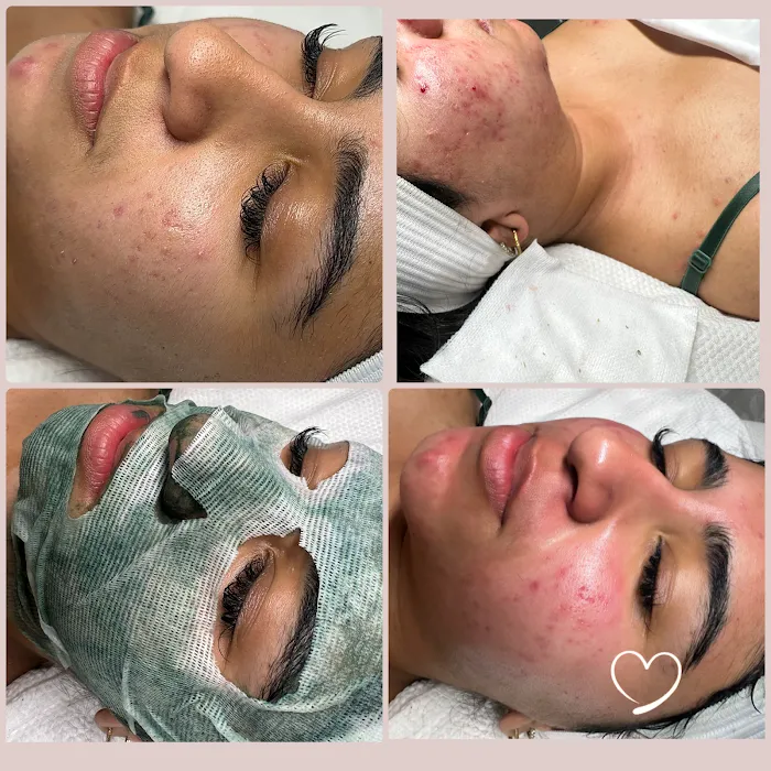 Fadia Beauty | Facial Salon near Van Nuys | Anti Aging Facial Picture 8