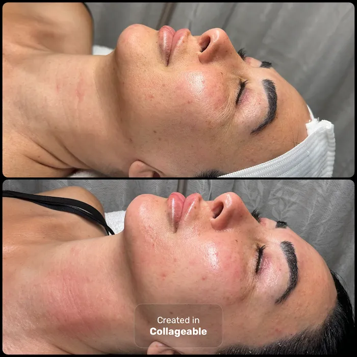 Fadia Beauty | Facial Salon near Van Nuys | Anti Aging Facial Picture 9