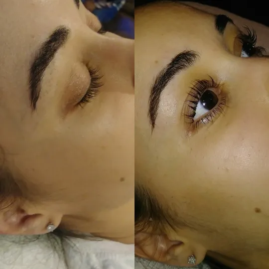 Colour Image Skin and Body Picture 10