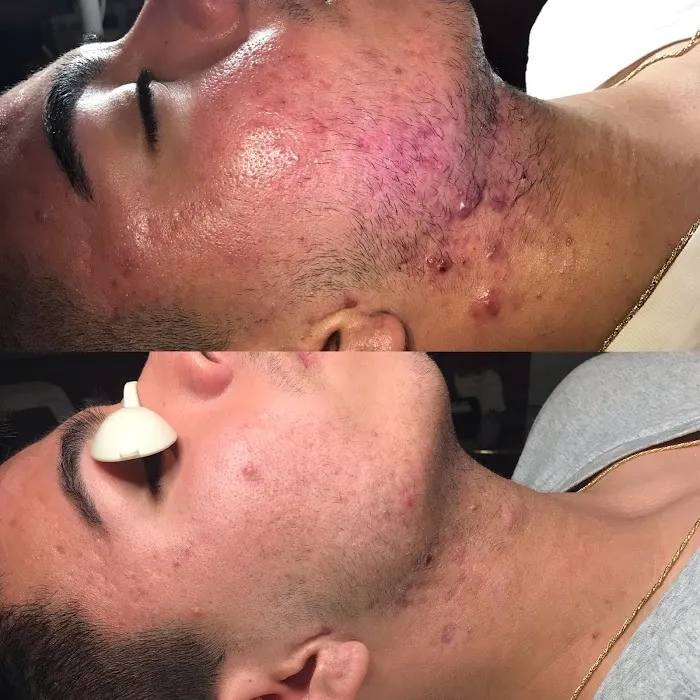 Goodie Glow Picture 5