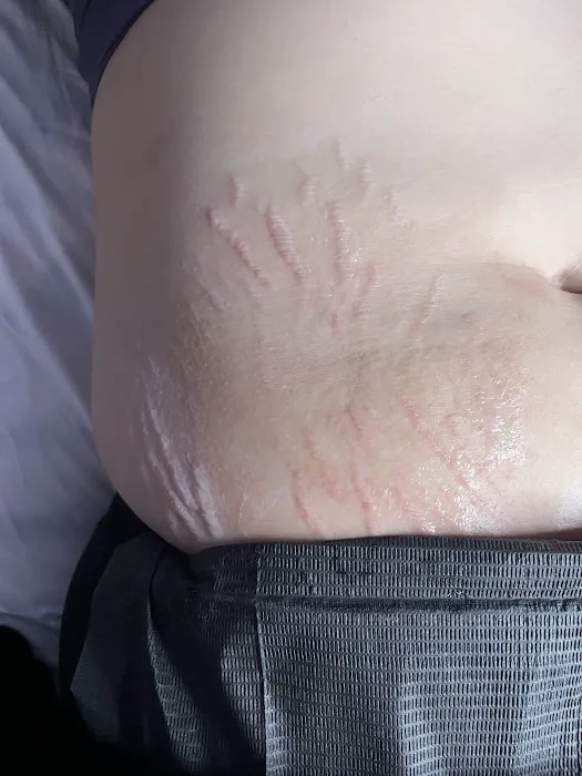 Glass Skin by Hailey Picture 2