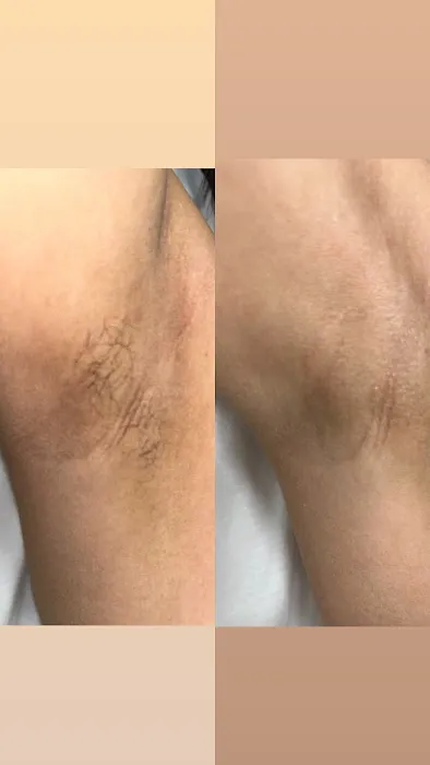 Glass Skin by Hailey Picture 1