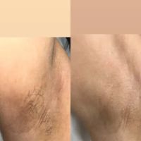 Glass Skin by Hailey ico