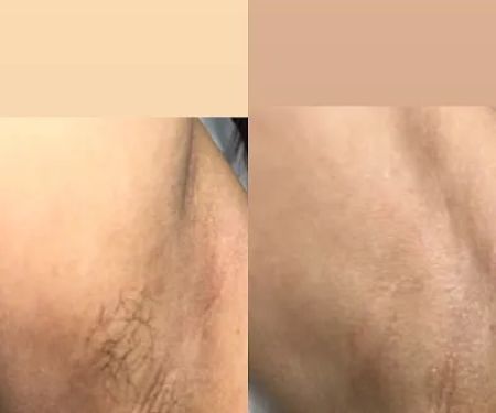 Glass Skin by Hailey