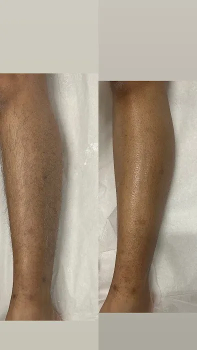 Glass Skin by Hailey Picture 3