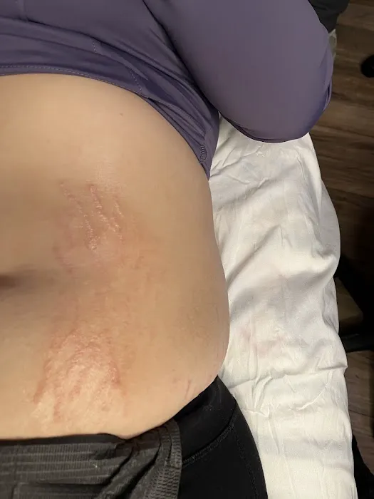 Glass Skin by Hailey Picture 5