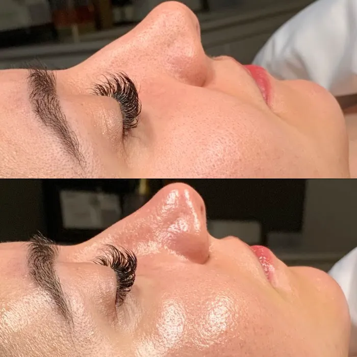 Inara Aesthetics Picture 3