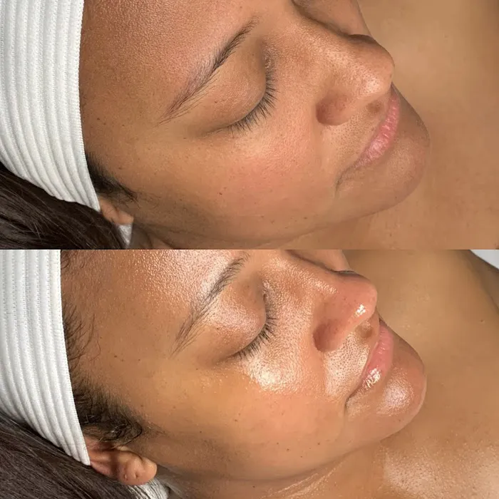 Inara Aesthetics Picture 6