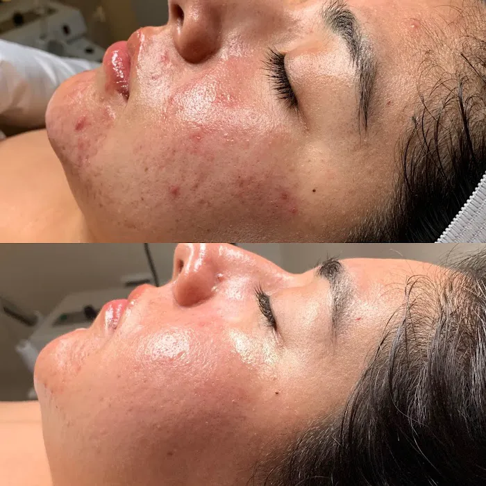 Inara Aesthetics Picture 7