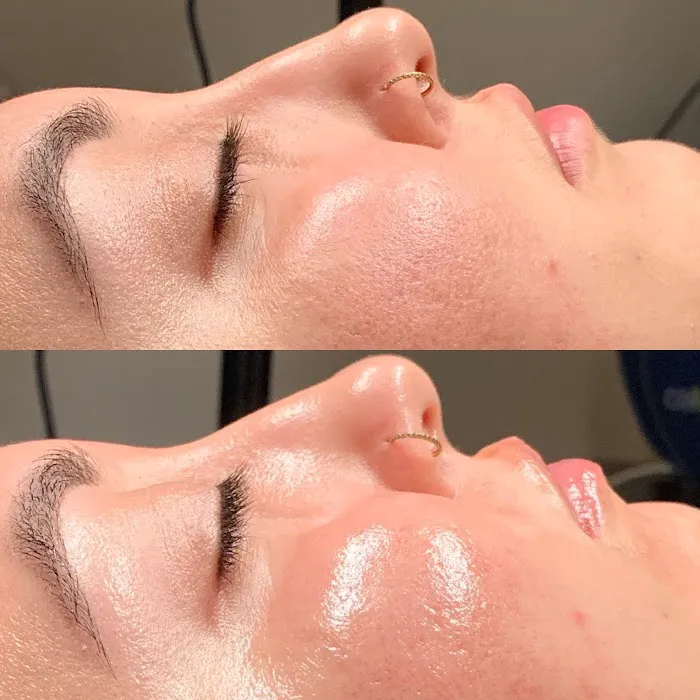 Inara Aesthetics Picture 10