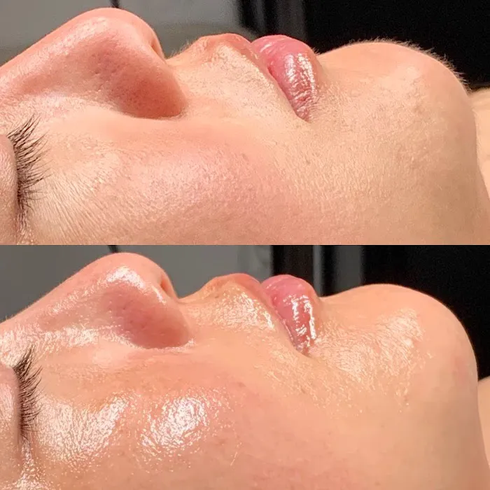 Inara Aesthetics Picture 9