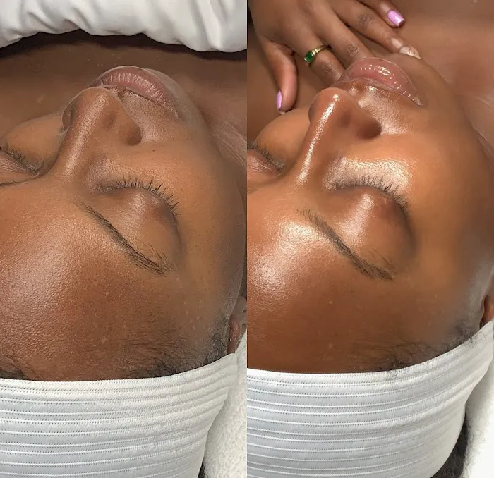 Inara Aesthetics Picture 8