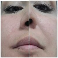 Lavish Skin and Beauty ico