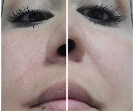 Lavish Skin and Beauty