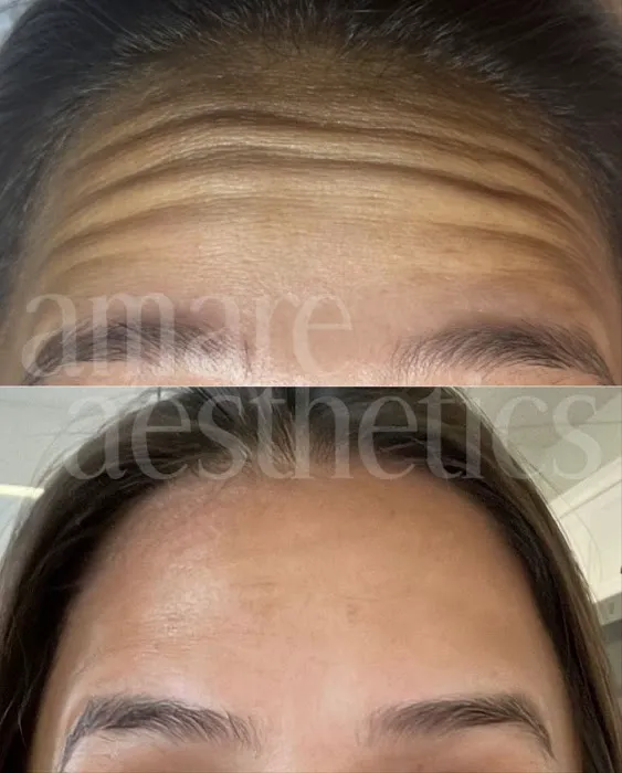 Amare Aesthetics Picture 4