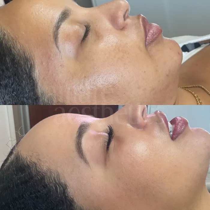 Amare Aesthetics Picture 6