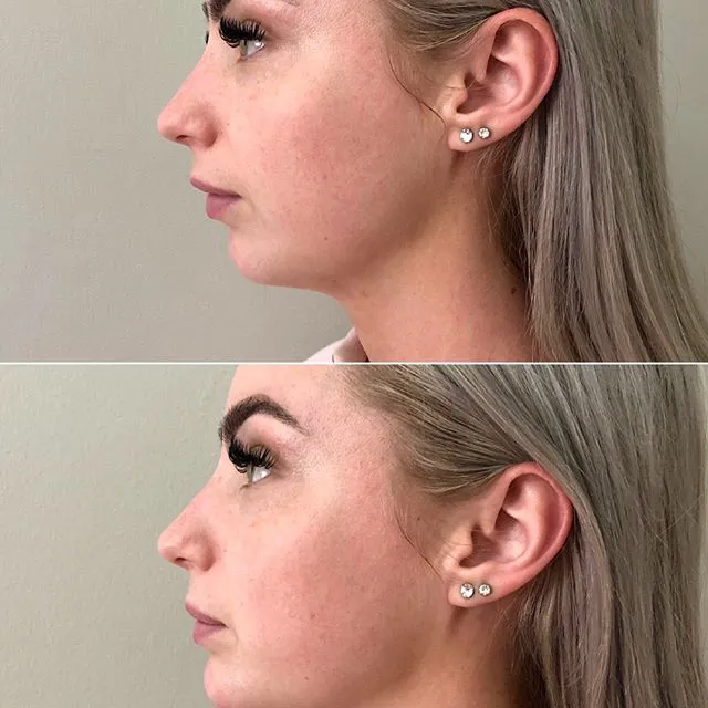 True Beauty Aesthetics Picture 8