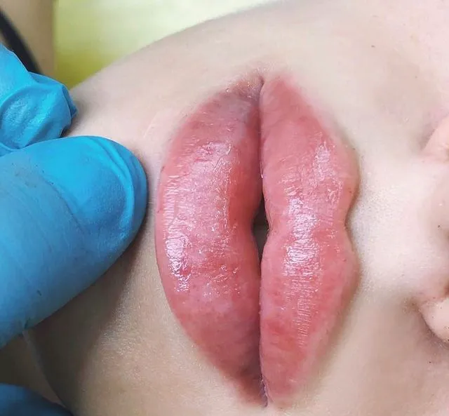 True Beauty Aesthetics Picture 9