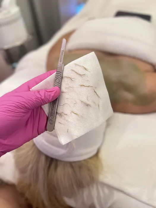 Christina Silva Aesthetics Picture 3