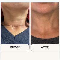 Advanced Skin Lab ico